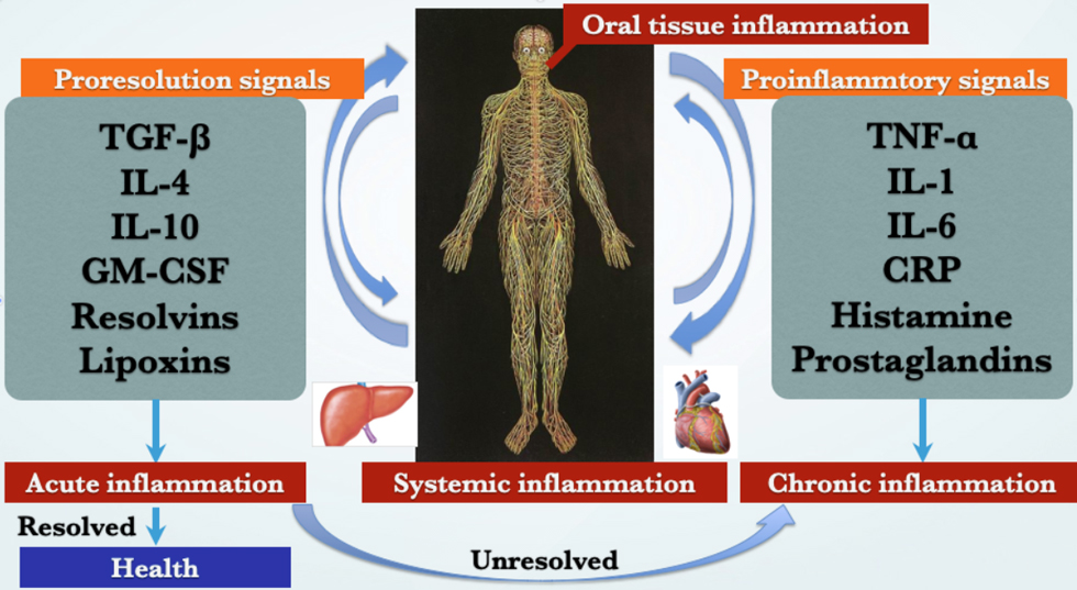 口腔の炎症が全身の炎症を引き起こす