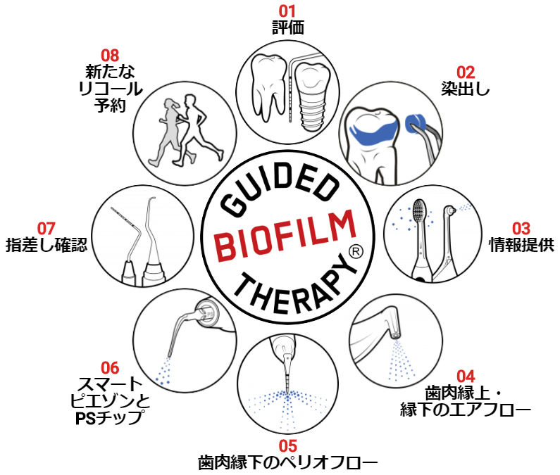 GBTプロトコール