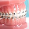 歯列矯正歯科治療